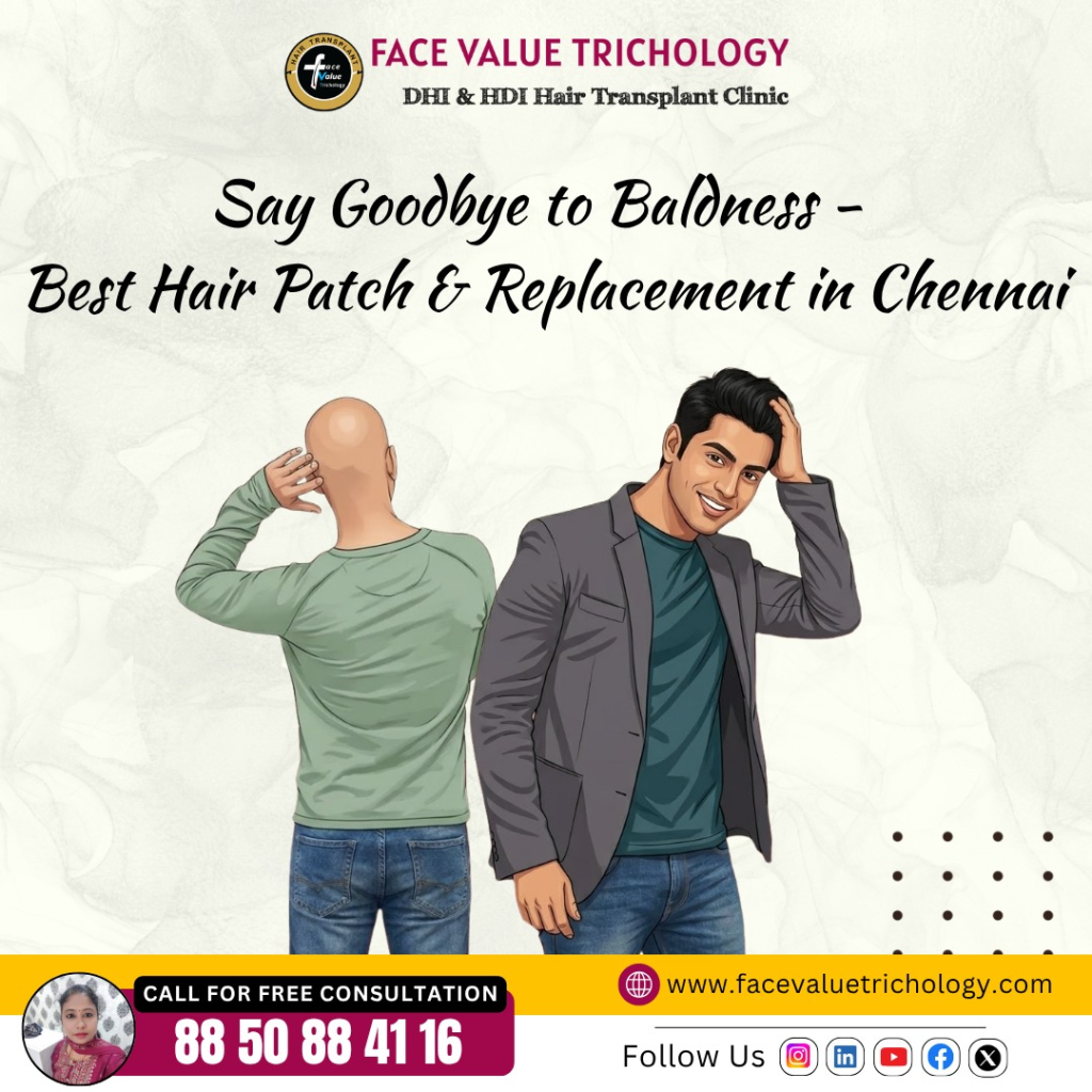 Best Hair Patch & Hair Replacement Treatment in Chennai | Non-Surgical Hair Solution