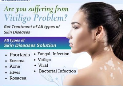 AROGYAM PURE HERBS KIT FOR VITILIGO service in OMR | ChennaiFreeAdz
